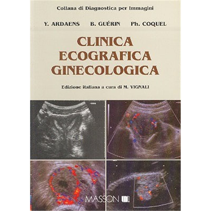 Clinica ecografica ginecologica